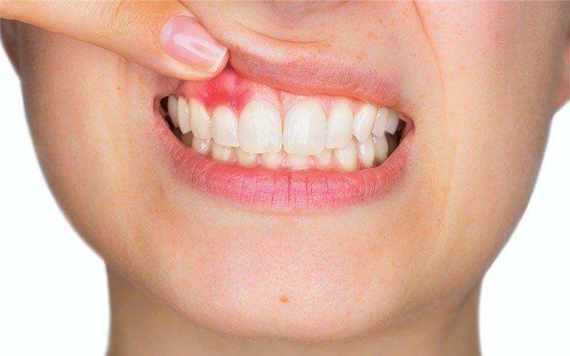 canal dentário