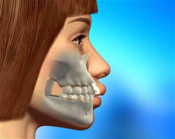 cirurgia de mandíbula