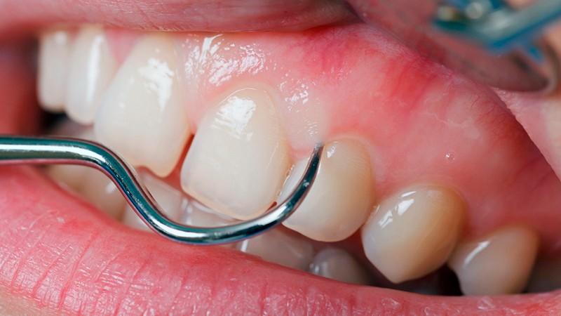 cirurgia dentaria correção
