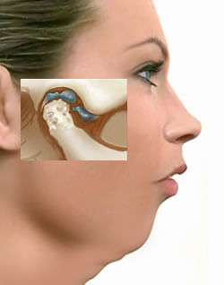 Cirurgia dtm