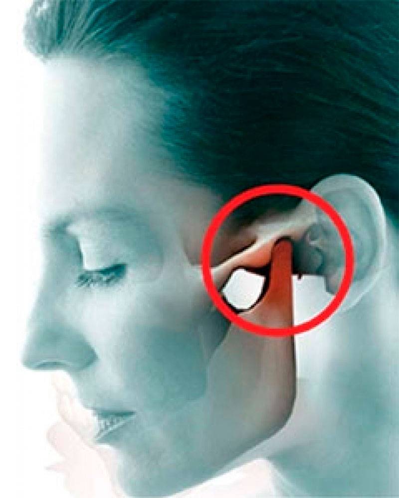 cirurgia mandibular atm