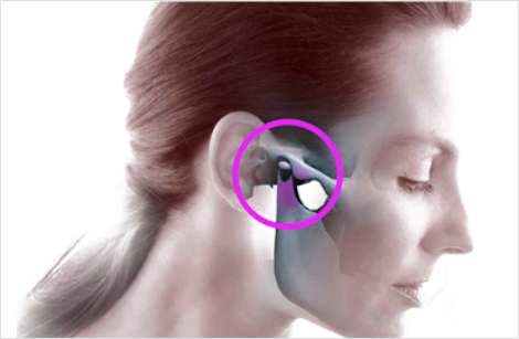 Cirurgia maxilofacial