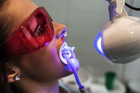clareamento a laser dental