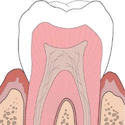 dente canal aberto doendo