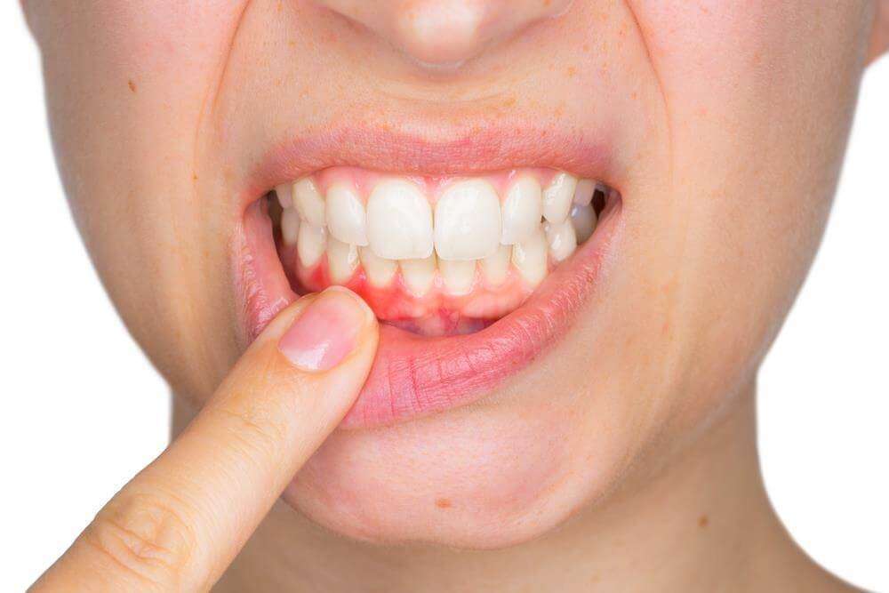 dor dente canal inflamado