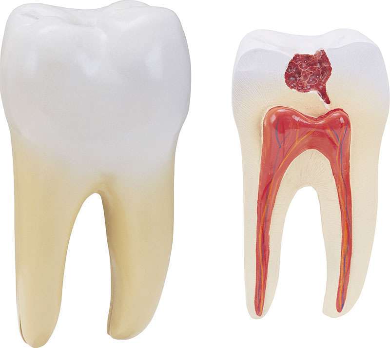 Especialista em canal de dente