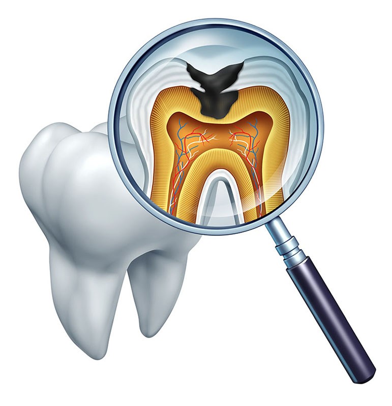 especialista em canal dentário