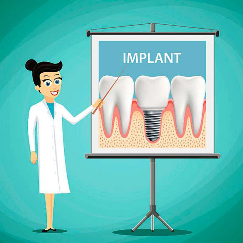 implante odontológico