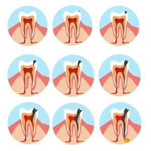 Lesões endo periodontais
