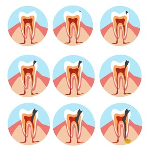 lesões endo periodontais