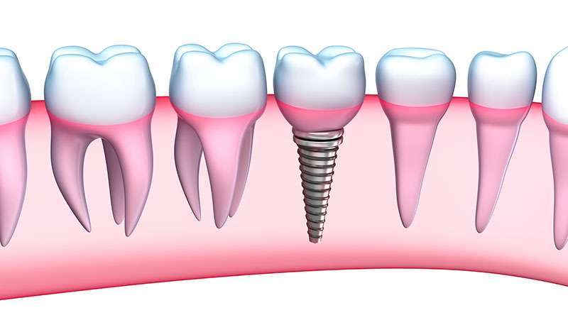 periodontista
