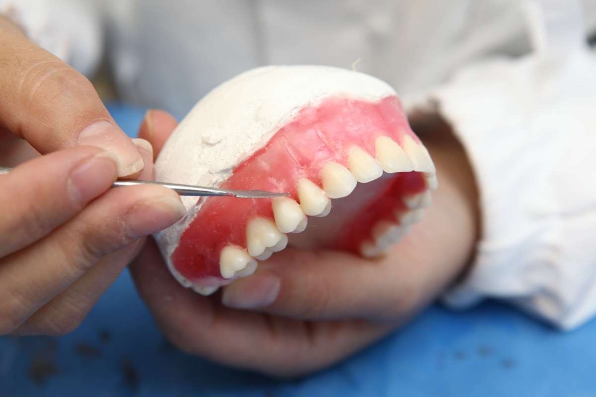 prótese dentes da frente