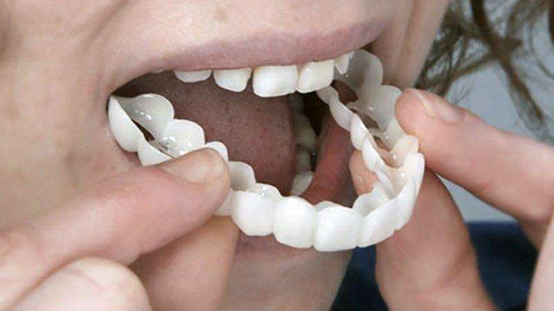 Capa Para Dentes De Porcelana