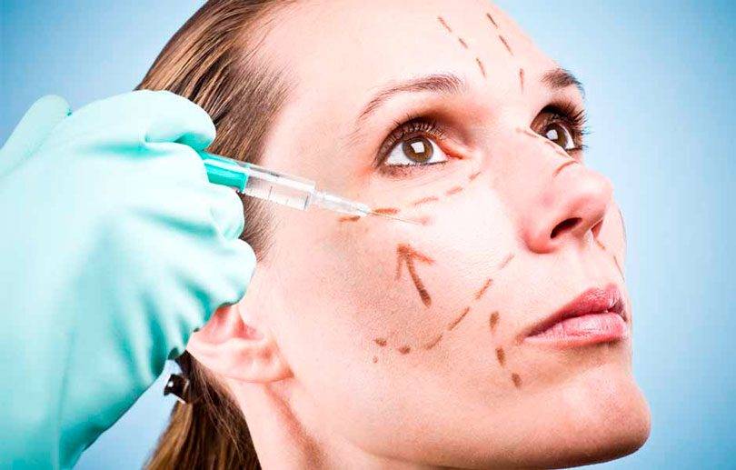 Cirurgia De Lifting Facial