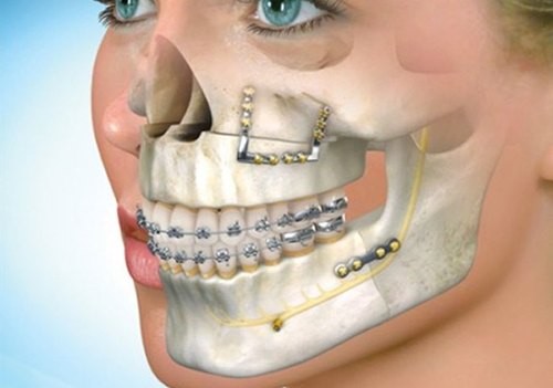 Cirurgia Dentária