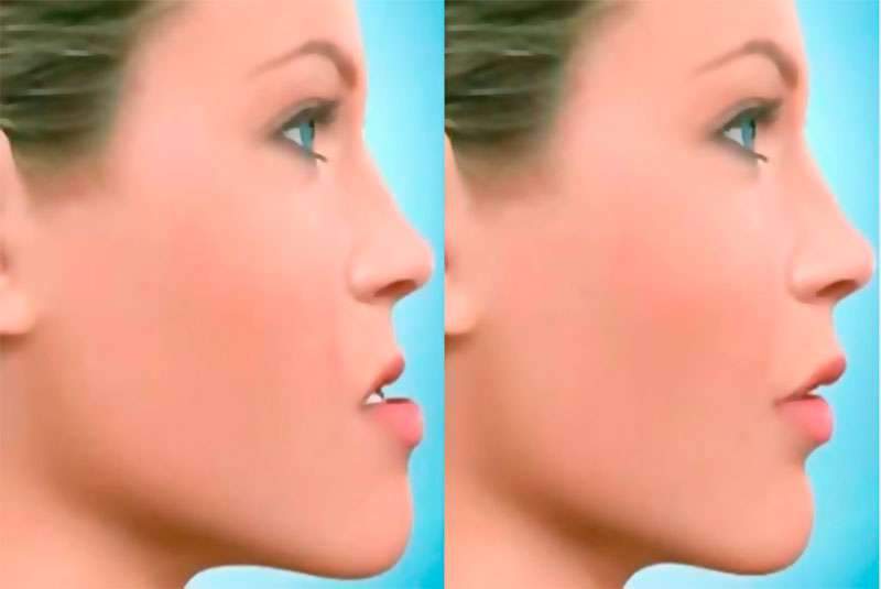 Cirurgia Maxilo Facial