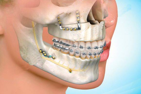Cirurgia Odontológica