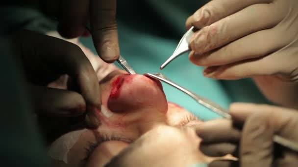 Cirurgia Oral E Maxilofacial