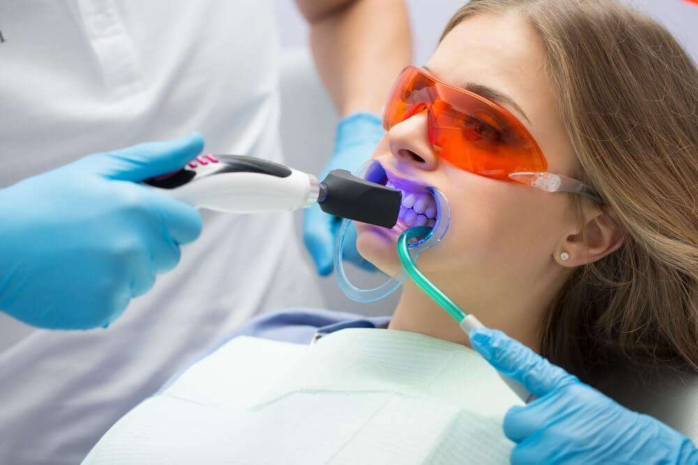 Clareamento Dental Consultório