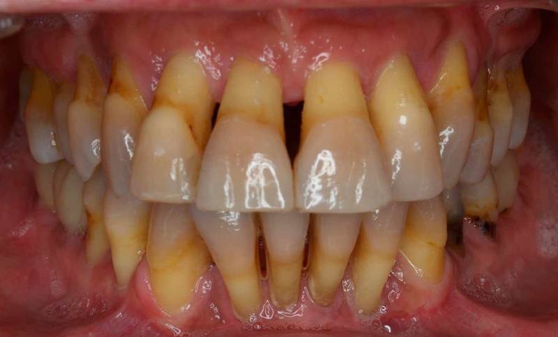 Clinicas Dentarias De Implantes