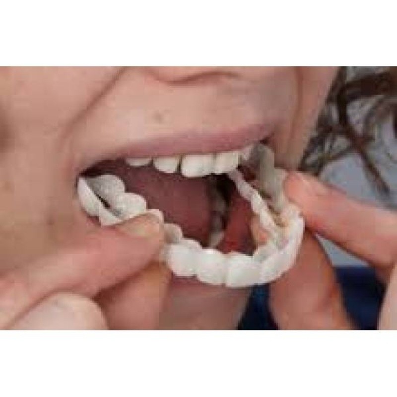 Lente De Contato Nos Dentes Quanto Custa